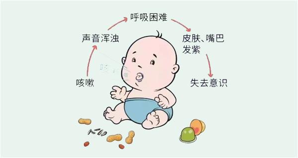 寶寶被噎住怎么辦？家長(cháng)應掌握“海姆立克急救法”